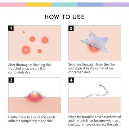 30 Pcs Pimple Patches