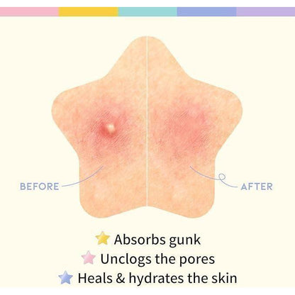 30 Pcs Pimple Patches